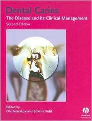 Dental Caries: The Disease and Its Clinical Management, (1405138890 