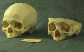 TWO real antique human skulls. Medical teaching aid. Estate sale. No 