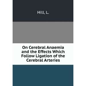   Effects Which Follow Ligation of the Cerebral Arteries L. Hill Books